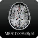 苹果板王！曝下一代iPad Pro升级为超窄边框